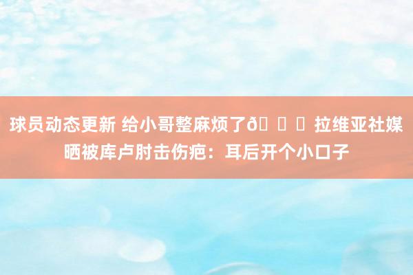 球员动态更新 给小哥整麻烦了😅拉维亚社媒晒被库卢肘击伤疤：耳后开个小口子